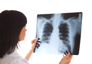 Female doctor looking at x-ray image on white